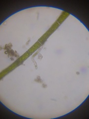 Strobilidium caudatum