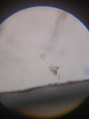 Strobilidium caudatum