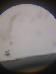 Strobilidium caudatum
