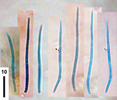 Septoria petroselini