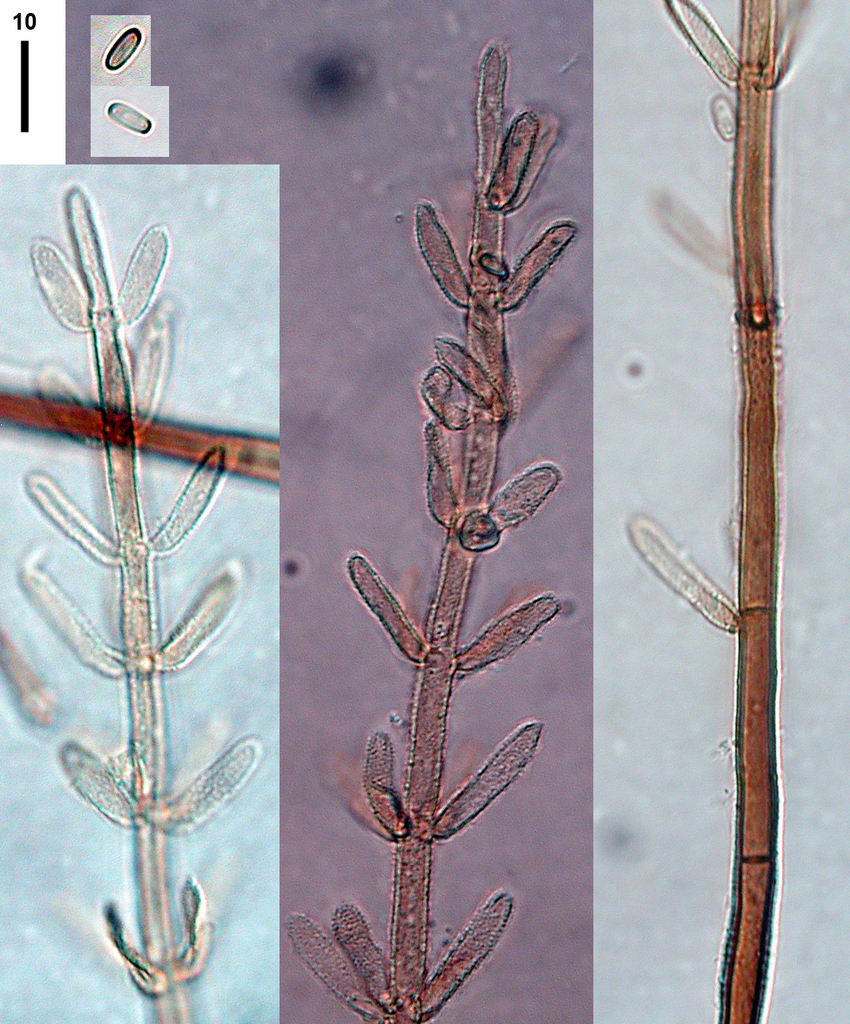 Plectosphaerellaceae