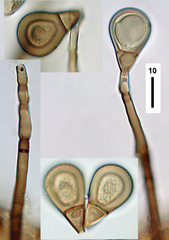 Endophragmiella boewei