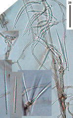 Subulispora britannica