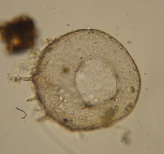 Centropyxis aculeata