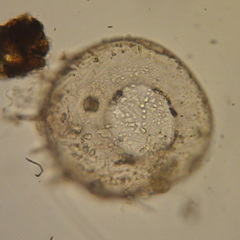 Centropyxis aculeata