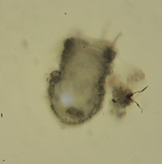 Codonella