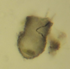 Codonella