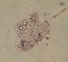 Amoebozoa