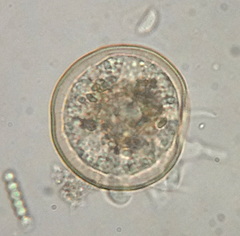 Lobosa