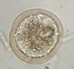 Lobosa