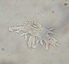 Rhizamoeba