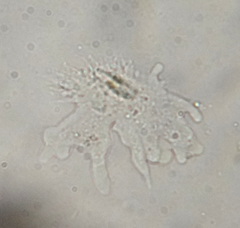 Rhizamoeba