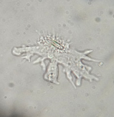 Rhizamoeba
