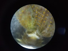 Sabellinae
