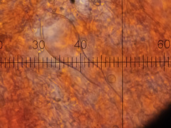 Vesiculomyces citrinus