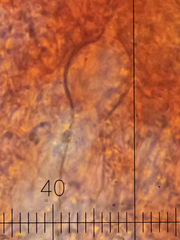 Vesiculomyces citrinus