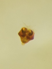 Eriovixia pseudocentrodes