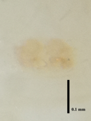 Meotipa spiniventris