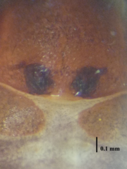 Oedignatha scrobiculata