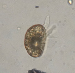 Lobosa