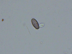 Ascobolus furfuraceus