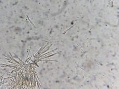 Lachnellula agassizii