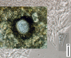 Stagonospora calystegiae