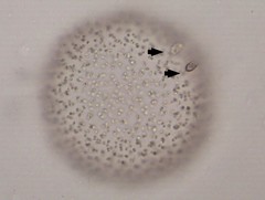 Bicoecida