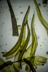 Racomitrium sudeticum
