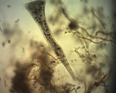 Stentor coeruleus