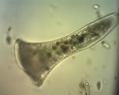 Stentor coeruleus