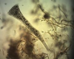 Stentor coeruleus
