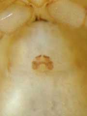 Cheiracanthium daquilium