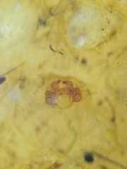Cheiracanthium daquilium