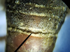 Cycloptilum kelainopum