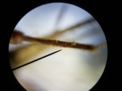 Cycloptilum kelainopum