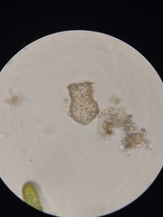 Codonella cratera