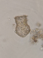 Codonella cratera