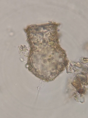 Codonella cratera