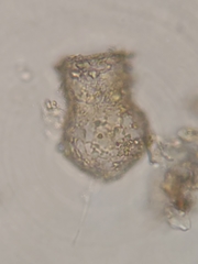 Codonella cratera