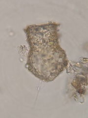 Codonella cratera