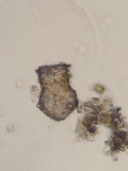 Codonella cratera