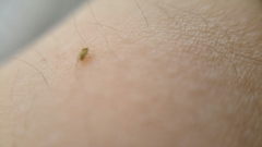 Hemiptera