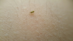 Hemiptera
