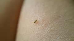 Hemiptera