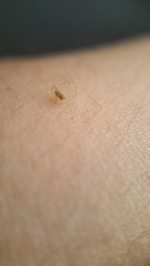 Hemiptera