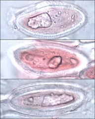 Pertusaria werneriana
