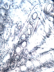 Pertusaria werneriana