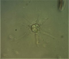 Raphidocystis