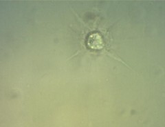 Raphidocystis